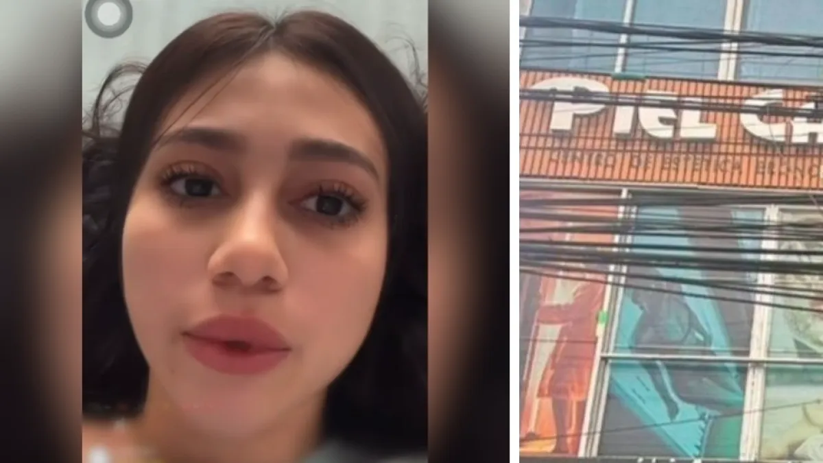 Clínica ilegal en Ibagué: nueva víctima de lipotransferencia habla