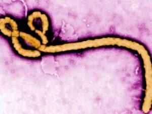 Nuevo brote de ébola en Congo: 65 muertos y 246 casos sospechosos