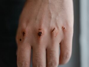 Olinia podría causar lesiones graves en un choque por falta de bolsas
