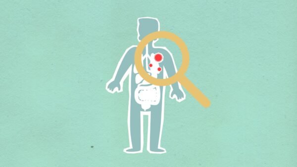 brote de cyclospora